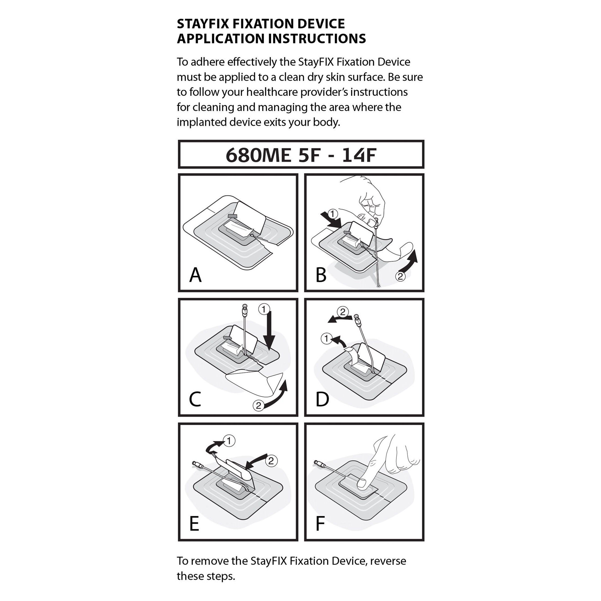 StayFIX Fixation Device for Percutaneous Catheters thumbnail 2