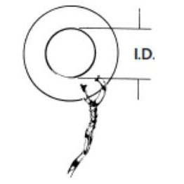 Collar Button Ear Ventilation Tube thumbnail 1