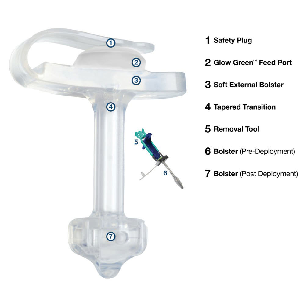 AMT MiniONE Low Profile Non-Balloon Button Gastrostomy Tube Kit thumbnail 4