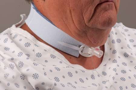 Dale Tracheostomy Tube Holders thumbnail 1
