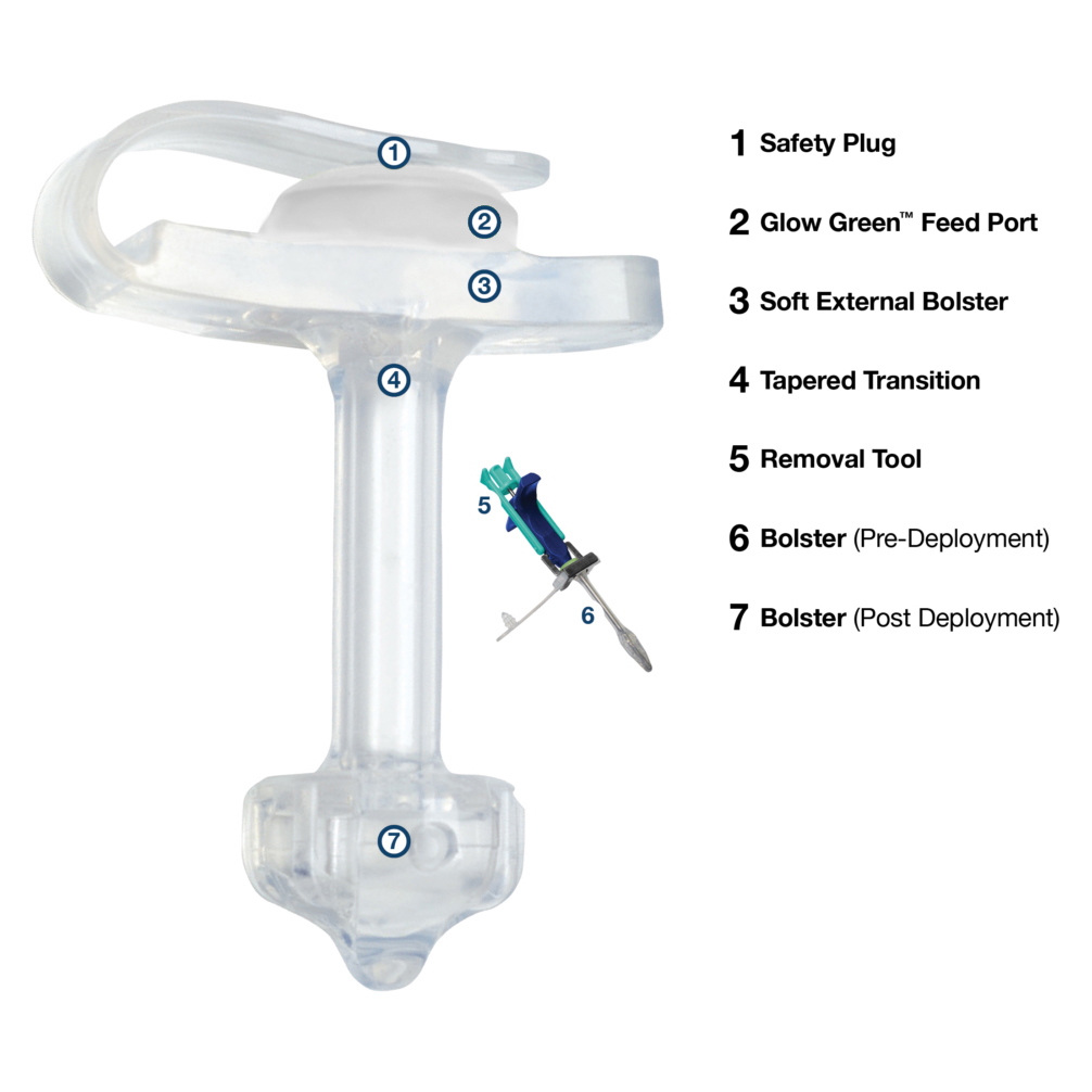 AMT MiniONE Low Profile Non-Balloon Button Gastrostomy Tube Kit thumbnail 4