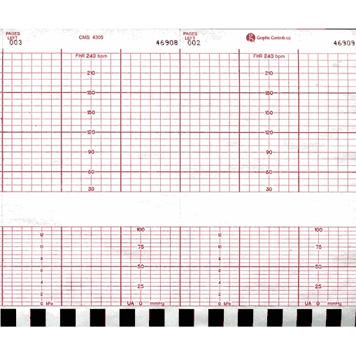 Corometrics Fetal Monitor ECG Chart Paper