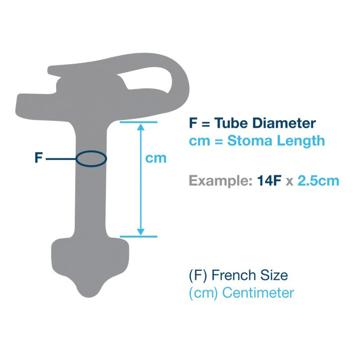 AMT MiniONE Low Profile Non-Balloon Button Gastrostomy Tube Kit thumbnail 3
