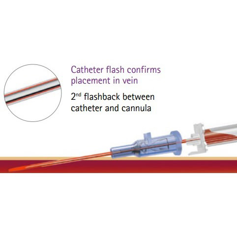 B. Braun Introcan Safety Peripheral IV Catheter with Winged Hub, Polyurethane thumbnail 3
