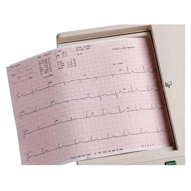 Welch Allyn Z-Fold ECG Recording Paper, 5-1/2 x 8-1/2 Inch