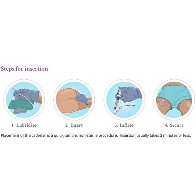 The Macy Catheter Rectal Medication Tube thumbnail 2