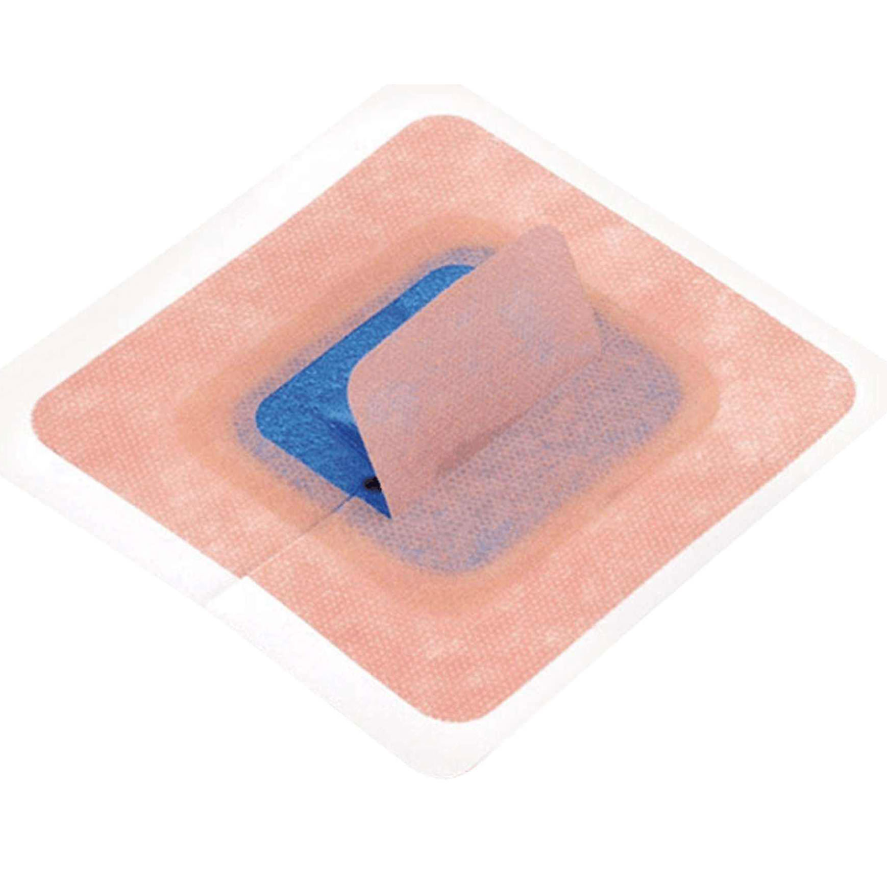 StayFIX Fixation Device for Percutaneous Catheters thumbnail 1