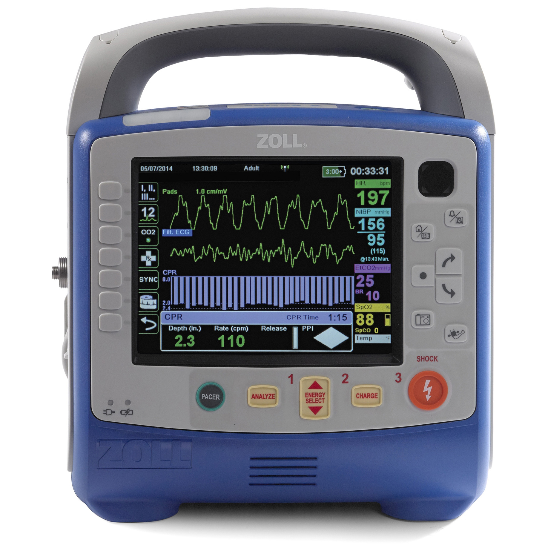 ZOLL X Series Training Defibrillator: AED Simulation for EMS Training