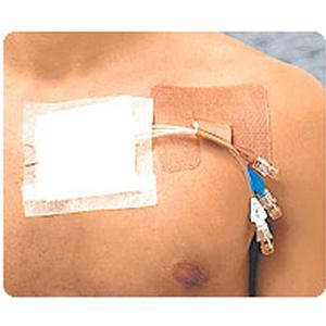 Cath-Strip Multi-Use Reclosable Catheter Fastener thumbnail 1