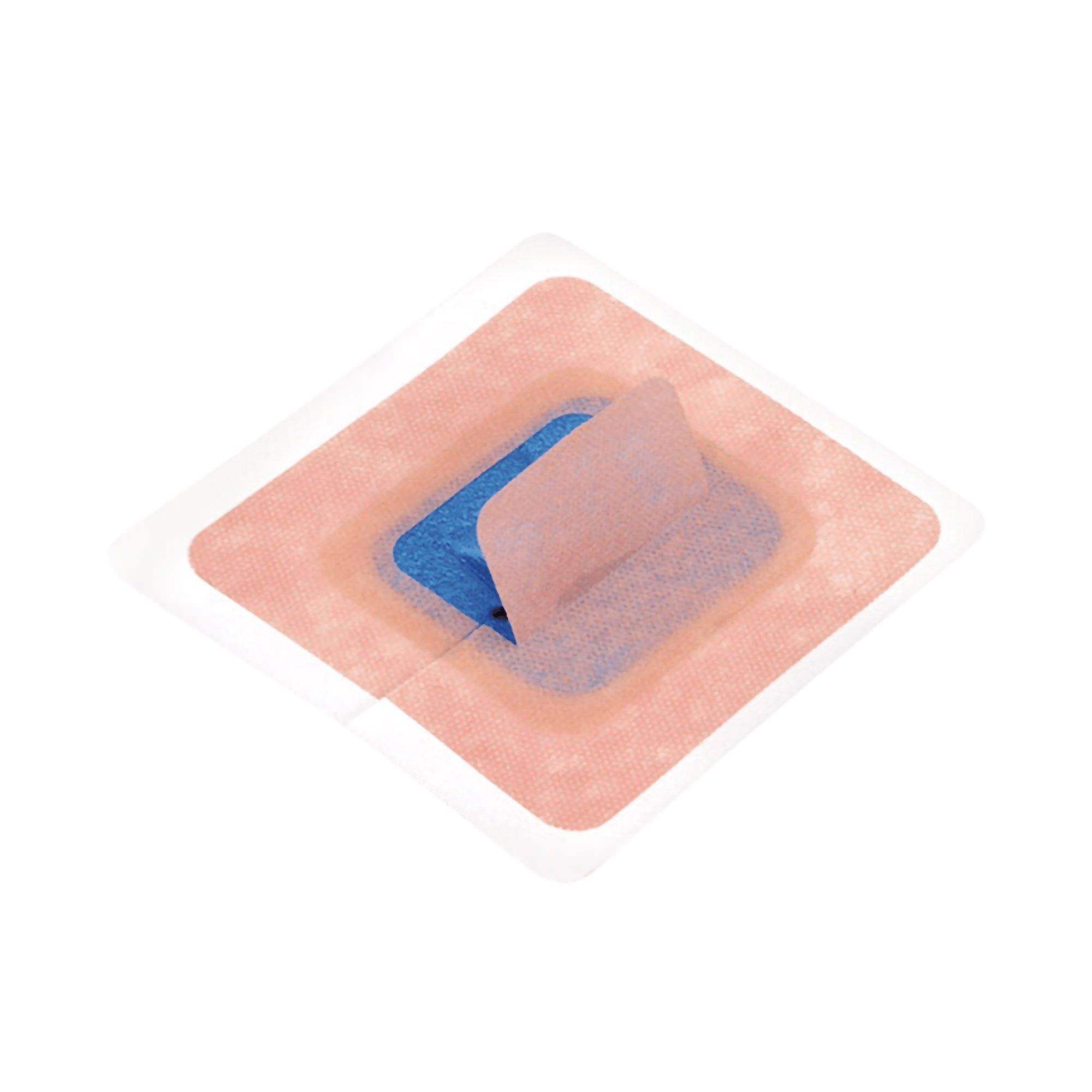 StayFIX Fixation Device for Percutaneous Catheters