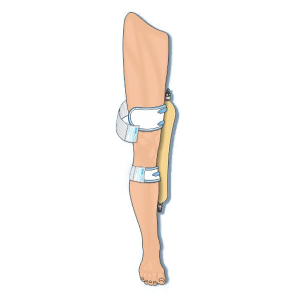 Urocare Washable Fabric Leg Bag Strap Kit thumbnail 3