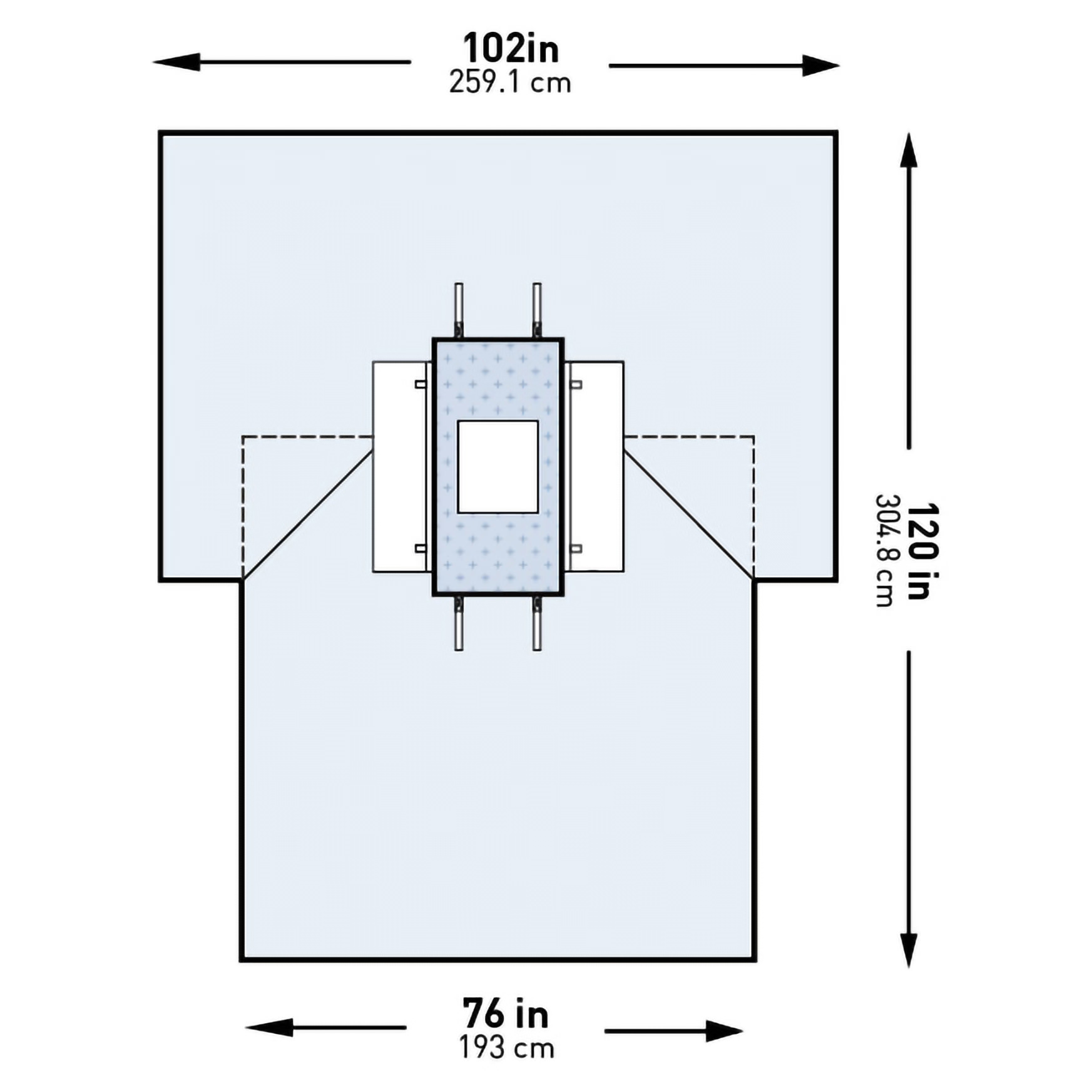 McKesson Abdominal Blue Laparotomy Drape