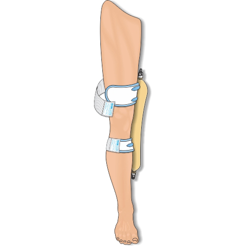 Urocare Fabric Leg Bag Strap thumbnail 4