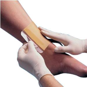 Replicare Hydrocolloid Wound Dressing thumbnail 1