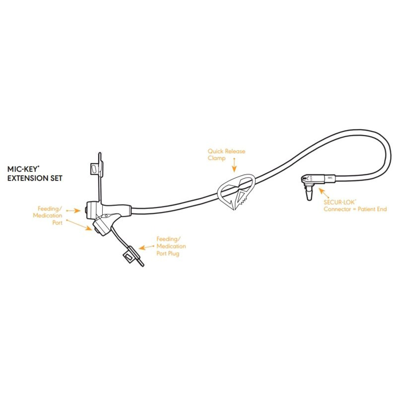 Mic-Key Gastrostomy Feeding Tube Kit thumbnail 5